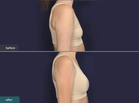 implant based image